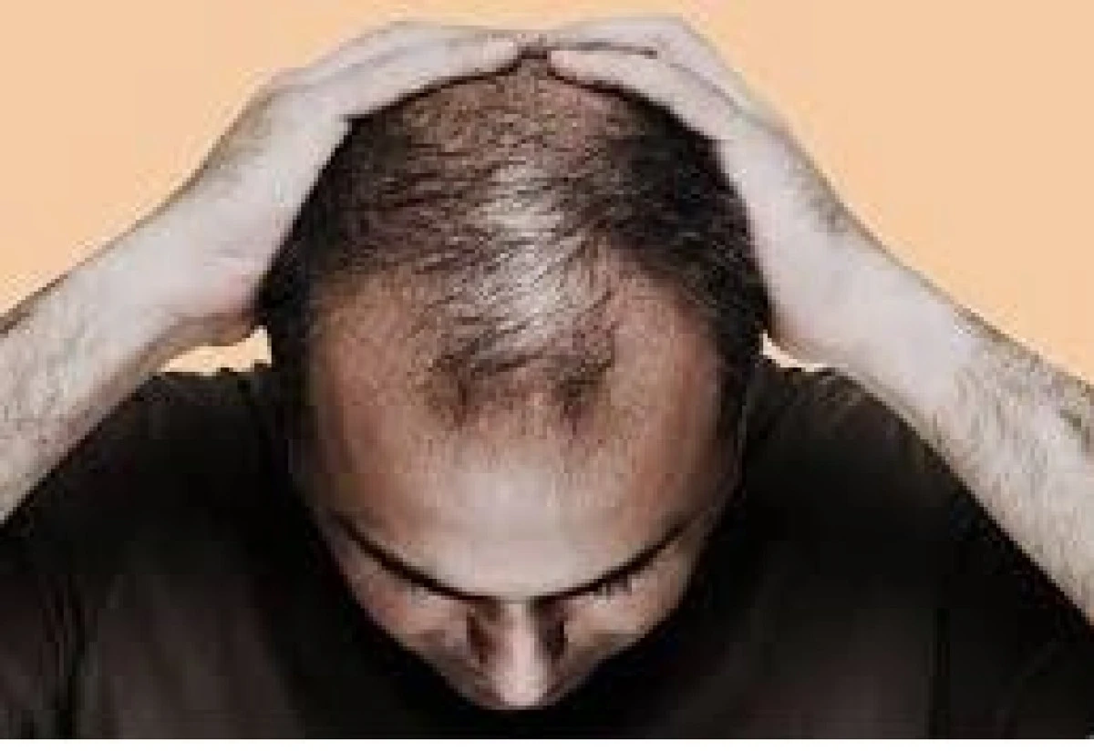 SA&Ccedil; D&Ouml;K&Uuml;LMESİNE YOL A&Ccedil;AN 9 &Ouml;NEMLİ ETKEN!